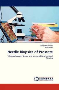 bokomslag Needle Biopsies of Prostate