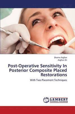 Post-Operative Sensitivity in Posterior Composite Placed Restorations 1