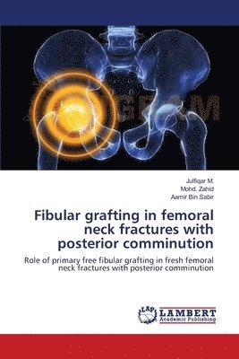 bokomslag Fibular grafting in femoral neck fractures with posterior comminution