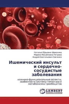 bokomslag Ishemicheskiy Insul't I Serdechno-Sosudistye Zabolevaniya