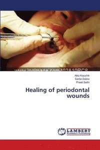 bokomslag Healing of periodontal wounds