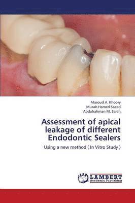 Assessment of Apical Leakage of Different Endodontic Sealers 1