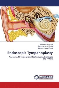 bokomslag Endoscopic Tympanoplasty