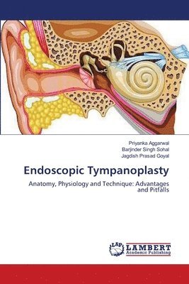 Priyanka Aggarwal, Barjinder Singh Sohal, Jagdish Prasad Goyal - Endoscopic Tympanoplasty, Häftad