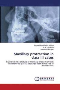 bokomslag Maxillary Protraction in Class III Cases
