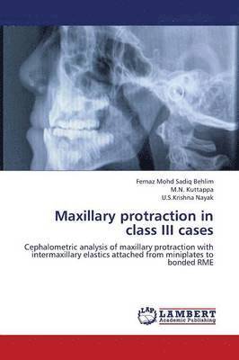 Maxillary Protraction in Class III Cases 1