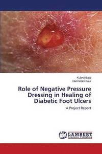 bokomslag Role of Negative Pressure Dressing in Healing of Diabetic Foot Ulcers