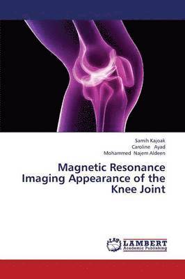 Magnetic Resonance Imaging Appearance of the Knee Joint 1