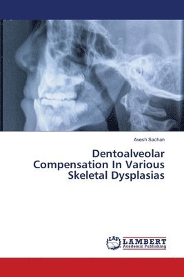 bokomslag Dentoalveolar Compensation In Various Skeletal Dysplasias