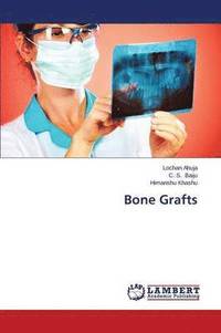 bokomslag Bone Grafts