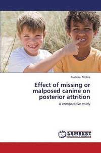 bokomslag Effect of Missing or Malposed Canine on Posterior Attrition
