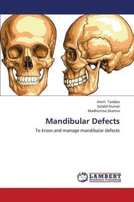 Mandibular Defects 1