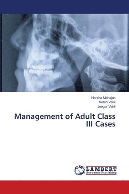 Management of Adult Class III Cases 1