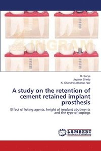 bokomslag A study on the retention of cement retained implant prosthesis