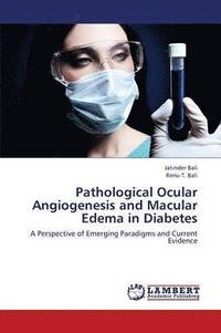 bokomslag Pathological Ocular Angiogenesis and Macular Edema in Diabetes