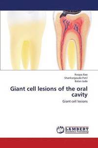 bokomslag Giant Cell Lesions of the Oral Cavity