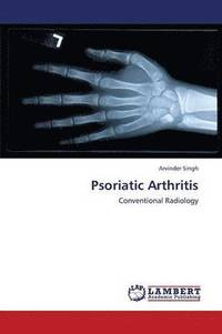 bokomslag Psoriatic Arthritis