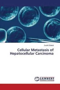 bokomslag Cellular Metastasis of Hepatocellular Carcinoma