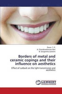 bokomslag Borders of Metal and Ceramic Copings and Their Influence on Aesthetics