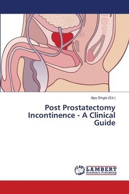 Post Prostatectomy Incontinence - A Clinical Guide 1