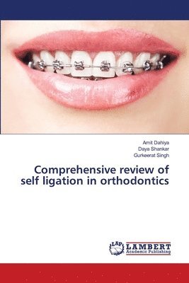 Comprehensive review of self ligation in orthodontics 1