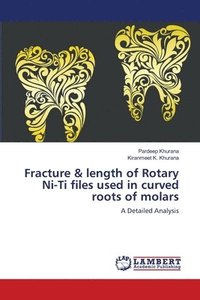 bokomslag Fracture & length of Rotary Ni-Ti files used in curved roots of molars