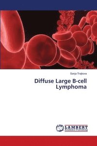 bokomslag Diffuse Large B-cell Lymphoma