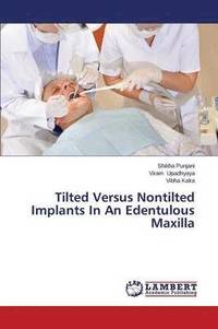 bokomslag Tilted Versus Nontilted Implants In An Edentulous Maxilla