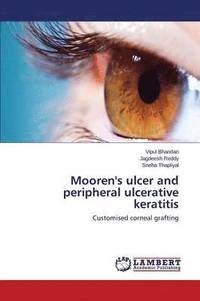 bokomslag Mooren's ulcer and peripheral ulcerative keratitis