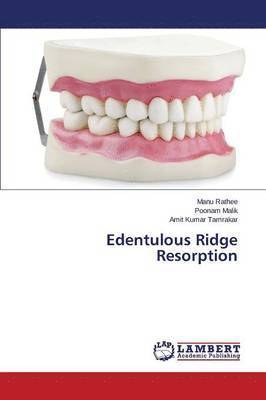 Edentulous Ridge Resorption 1