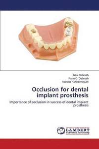 bokomslag Occlusion for Dental Implant Prosthesis