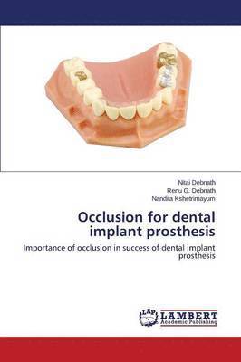Occlusion for Dental Implant Prosthesis 1
