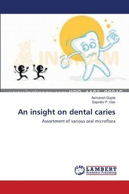 An insight on dental caries 1