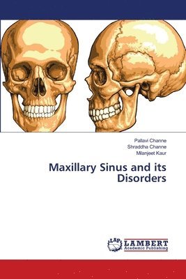 Maxillary Sinus and its Disorders 1