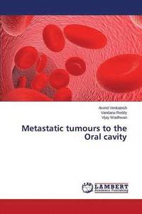 bokomslag Metastatic tumours to the Oral cavity