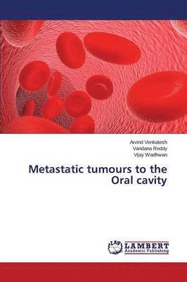 Metastatic tumours to the Oral cavity 1