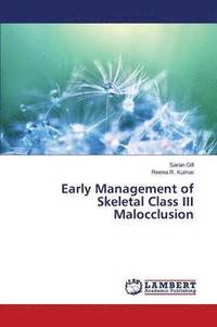 bokomslag Early Management of Skeletal Class III Malocclusion