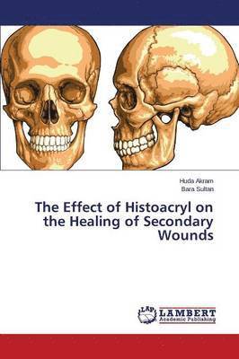 bokomslag The Effect of Histoacryl on the Healing of Secondary Wounds