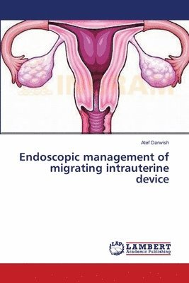 Endoscopic management of migrating intrauterine device 1