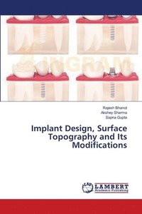 bokomslag Implant Design, Surface Topography and Its Modifications