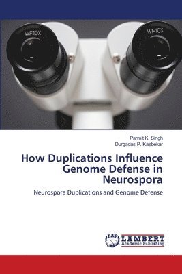 How Duplications Influence Genome Defense in Neurospora 1