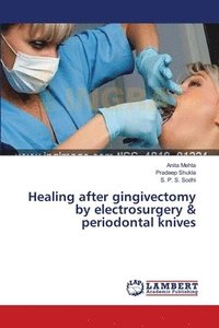 bokomslag Healing after gingivectomy by electrosurgery & periodontal knives