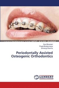 bokomslag Periodontally Assisted Osteogenic Orthodontics
