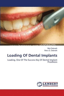 bokomslag Loading Of Dental Implants