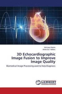 bokomslag 3D Echocardiographic Image Fusion to Improve Image Quality