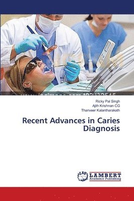 Recent Advances in Caries Diagnosis 1