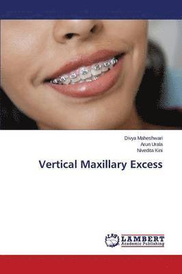 Vertical Maxillary Excess 1