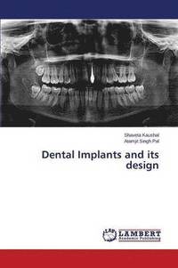 bokomslag Dental Implants and Its Design