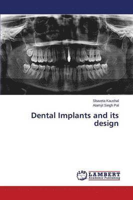 Dental Implants and Its Design 1