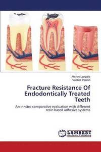 bokomslag Fracture Resistance of Endodontically Treated Teeth